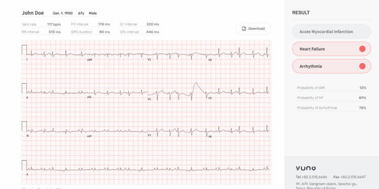 Ministry of Food and Drug Safety(KFDA) designates VUNO Med®-DeepECG™, an AI based electrocardiogram(ECG) analysis software, as a Breakthrough Device.