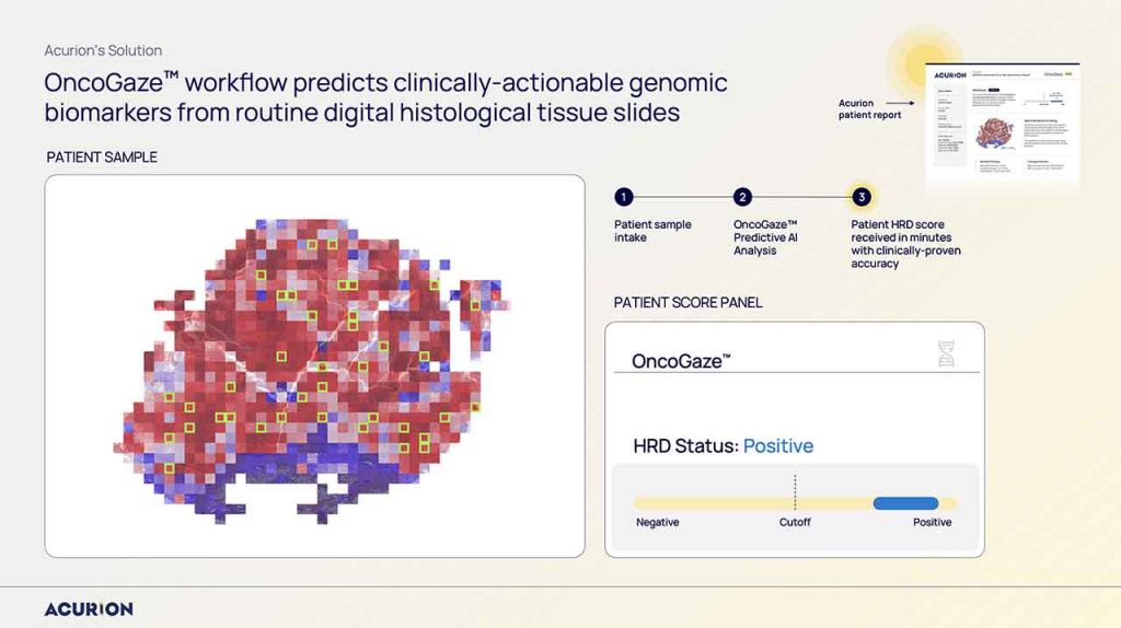 Acurion shares how its AI-driven cancer genomics platform advanced global partnerships and Korea expansion through K-Startup Grand Challenge 2025.